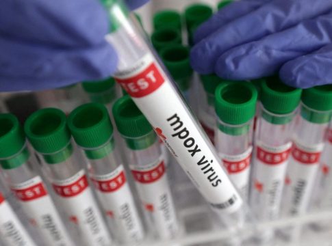 Συναγερμός στον ΕΟΔΥ για τον ιό mpox – 18 επιβεβαιωμένα κρούσματα στην Ελλάδα